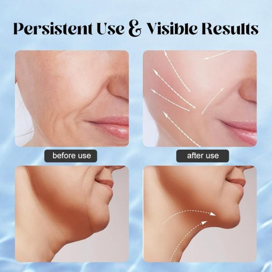 Facial & Neck Massager – EMS & Red Light Therapy